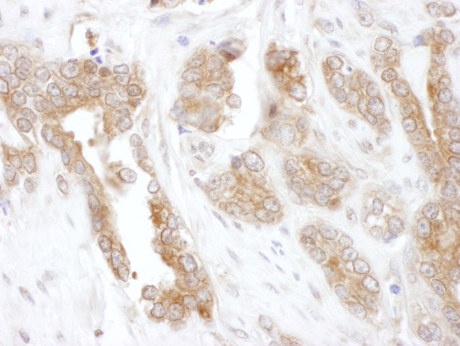 CCT5 Antibody in Immunohistochemistry (Paraffin) (IHC (P))