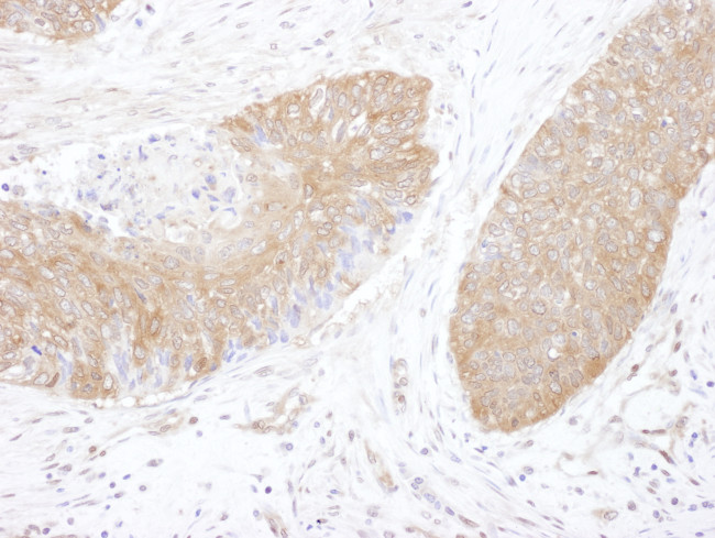 CCT5 Antibody in Immunohistochemistry (Paraffin) (IHC (P))