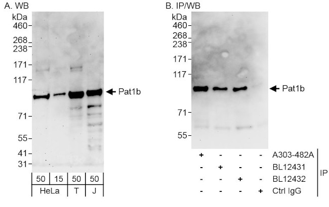 Pat1b Antibody in Western Blot (WB)