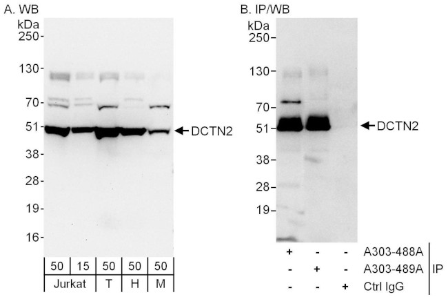 DCTN2 Antibody in Western Blot (WB)