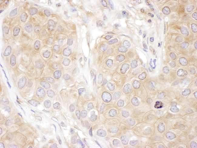 DCTN2 Antibody in Immunohistochemistry (Paraffin) (IHC (P))