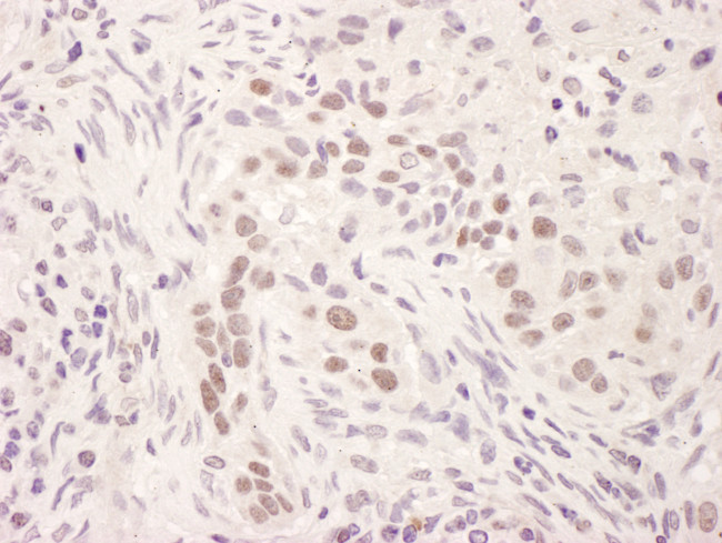 GR Antibody in Immunohistochemistry (Paraffin) (IHC (P))