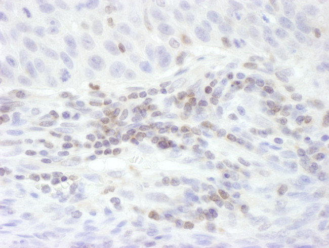 STAT5b Antibody in Immunohistochemistry (Paraffin) (IHC (P))