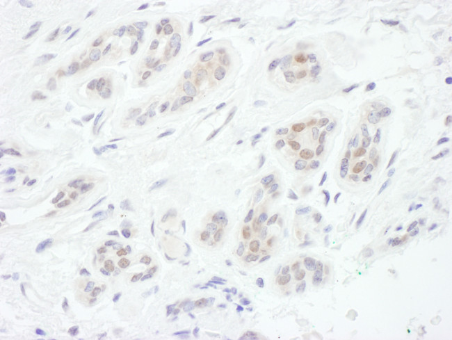 FOXC1 Antibody in Immunohistochemistry (Paraffin) (IHC (P))