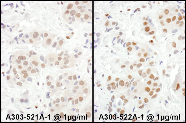 MEF2D Antibody in Immunohistochemistry (Paraffin) (IHC (P))