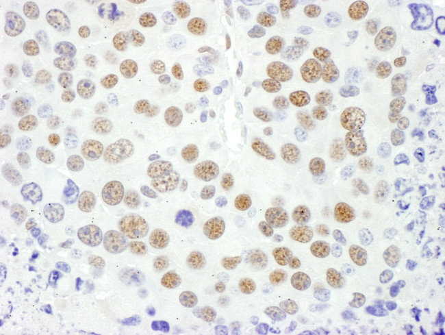 MEF2D Antibody in Immunohistochemistry (Paraffin) (IHC (P))