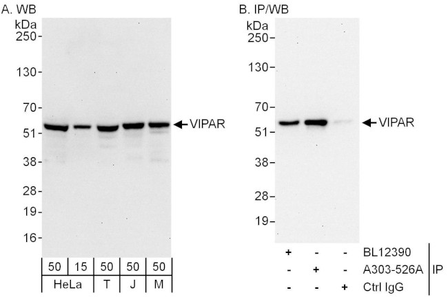 VIPAR Antibody in Western Blot (WB)