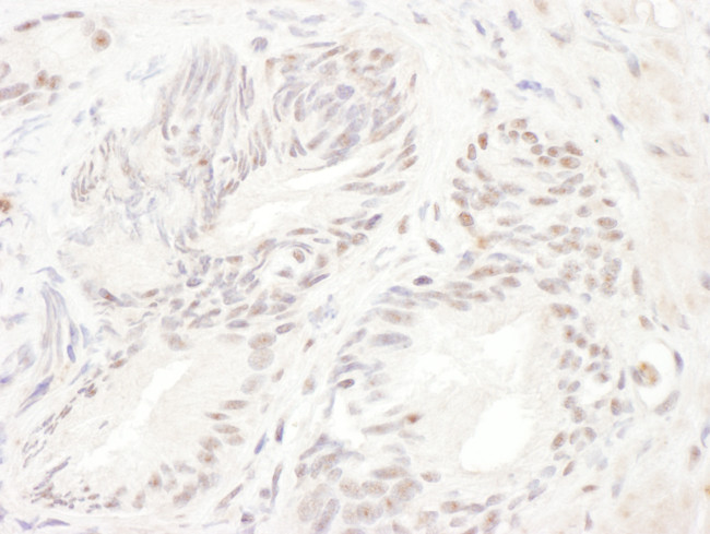 ELK1 Antibody in Immunohistochemistry (Paraffin) (IHC (P))