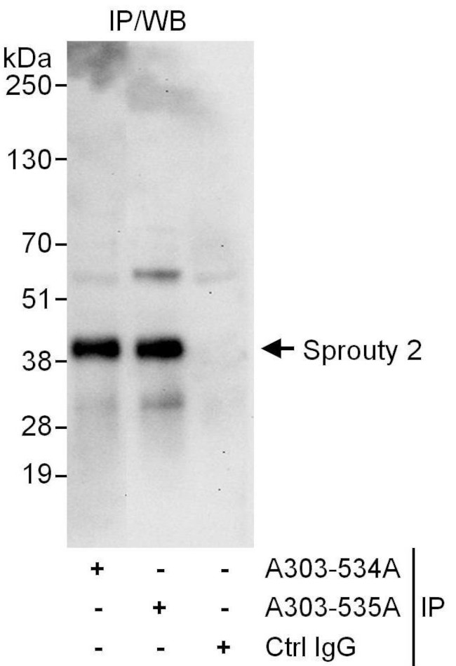 Sprouty 2 Antibody in Immunoprecipitation (IP)