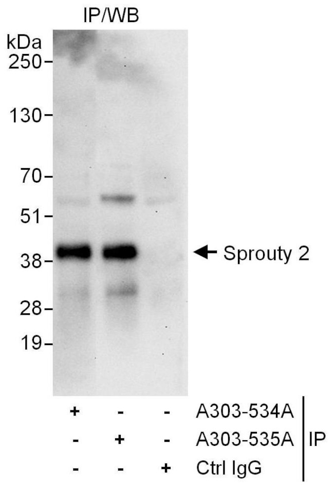 Sprouty 2 Antibody in Immunoprecipitation (IP)