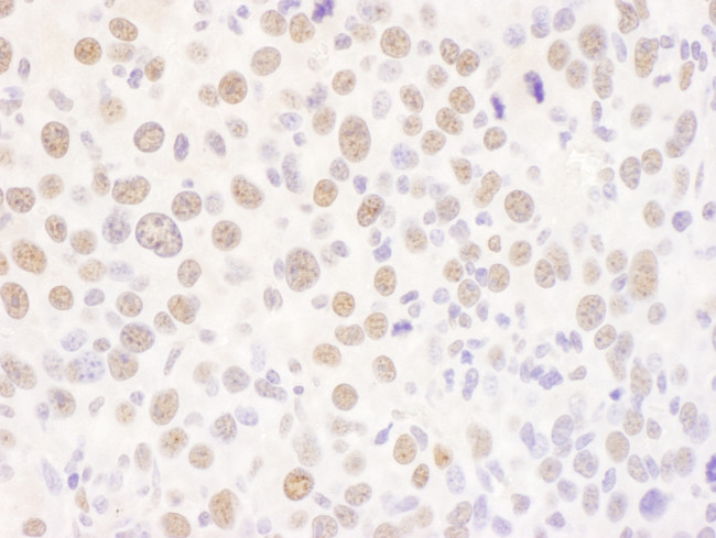 USF2 Antibody in Immunohistochemistry (Paraffin) (IHC (P))