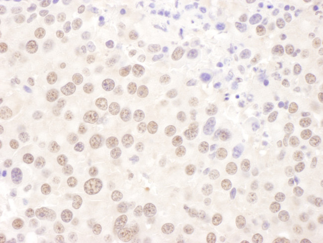 USF2 Antibody in Immunohistochemistry (Paraffin) (IHC (P))