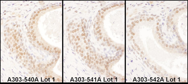 USF2 Antibody in Immunohistochemistry (Paraffin) (IHC (P))
