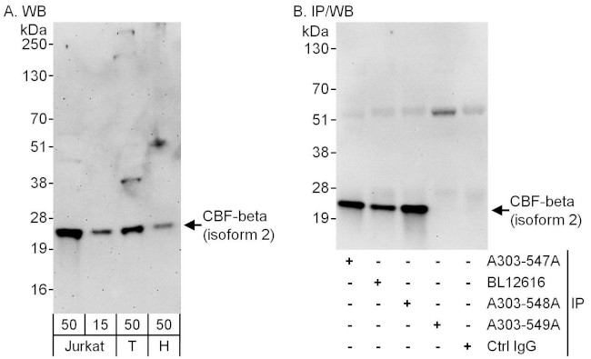 CBF-beta (isoform 2) Antibody in Western Blot (WB)