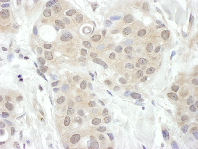 FIH-1 Antibody in Immunohistochemistry (Paraffin) (IHC (P))