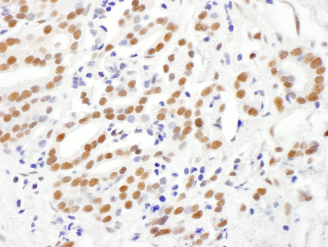 RING1 Antibody in Immunohistochemistry (Paraffin) (IHC (P))