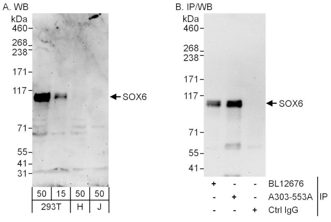 SOX6 Antibody in Western Blot (WB)