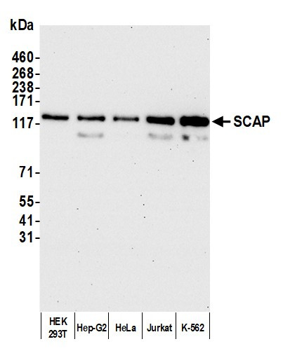 SCAP Antibody in Western Blot (WB)