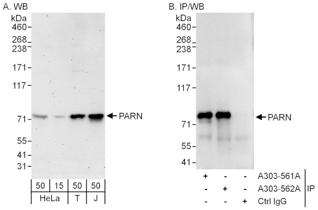 PARN Antibody in Western Blot (WB)