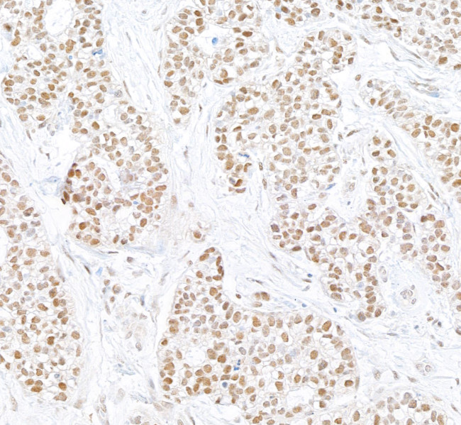 PARN Antibody in Immunohistochemistry (Paraffin) (IHC (P))