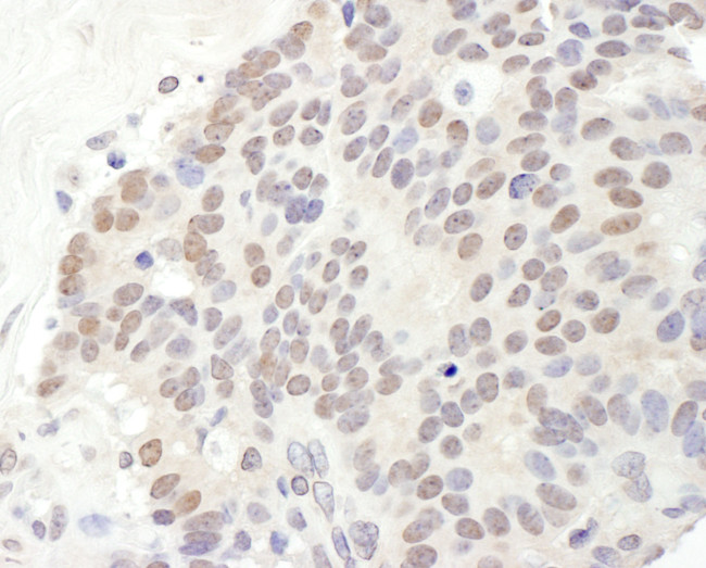 TRPS1 Antibody in Immunohistochemistry (Paraffin) (IHC (P))