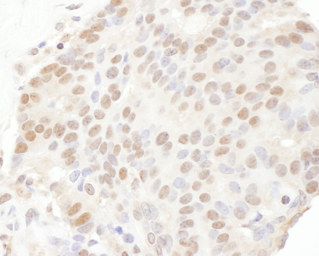 TRPS1 Antibody in Immunohistochemistry (Paraffin) (IHC (P))