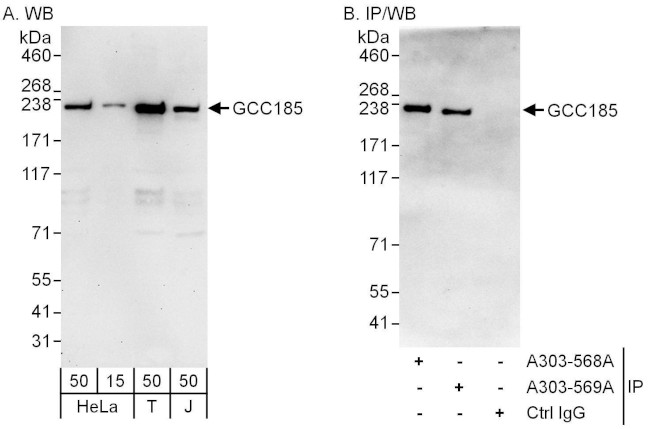 GCC185 Antibody in Western Blot (WB)