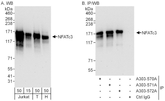 NFATc3 Antibody in Western Blot (WB)