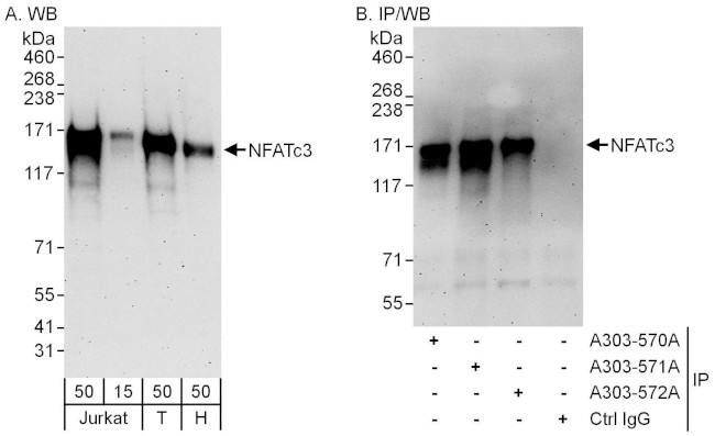 NFATc3 Antibody in Western Blot (WB)