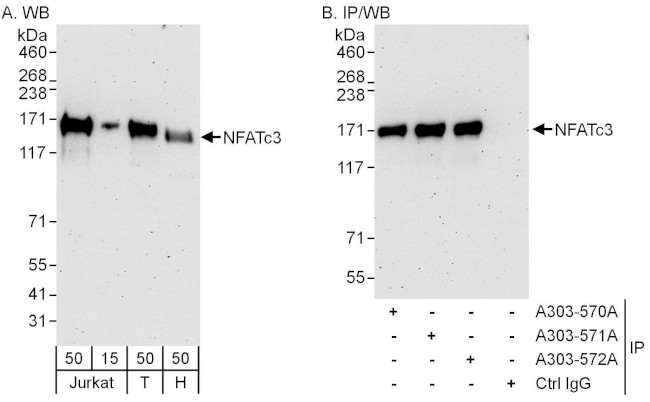 NFATc3 Antibody in Western Blot (WB)