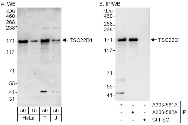 TSC22D1 Antibody in Western Blot (WB)