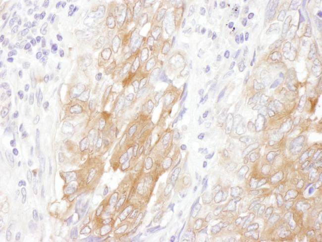 LIN28B Antibody in Immunohistochemistry (Paraffin) (IHC (P))