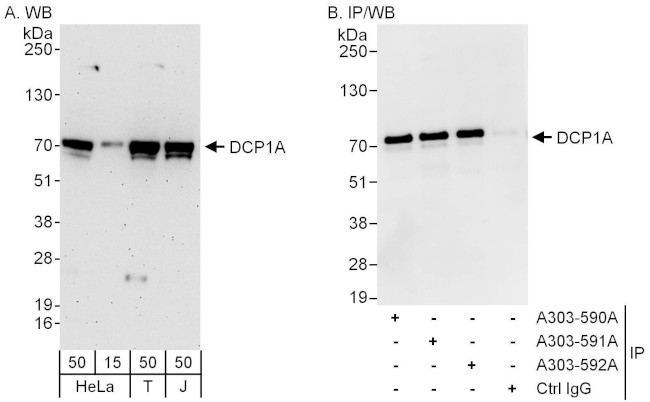 DCP1A Antibody in Western Blot (WB)