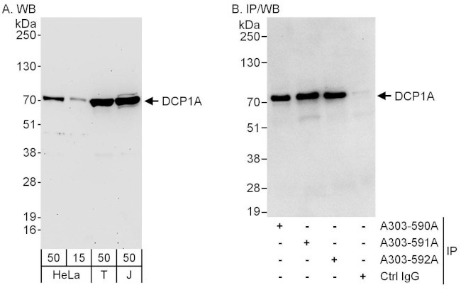 DCP1A Antibody in Western Blot (WB)