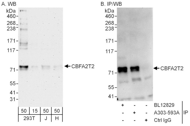 CBFA2T2 Antibody in Western Blot (WB)
