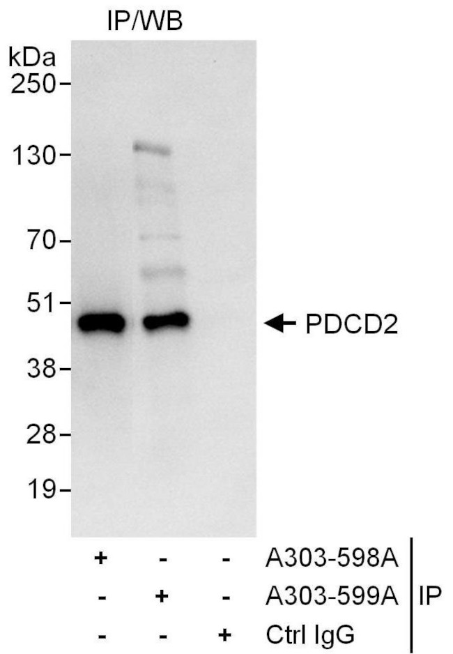 PDCD2 Antibody in Immunoprecipitation (IP)
