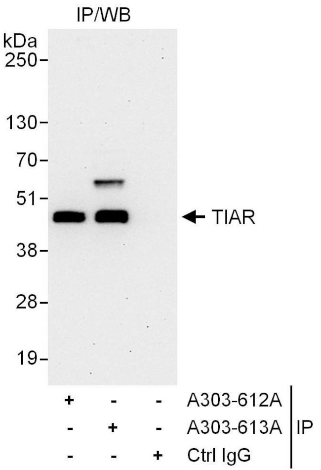 TIAR Antibody in Immunoprecipitation (IP)