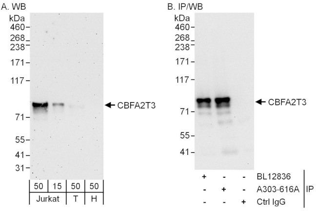 CBFA2T3 Antibody in Western Blot (WB)