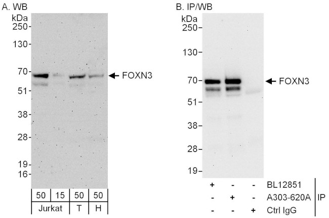 FOXN3 Antibody in Western Blot (WB)