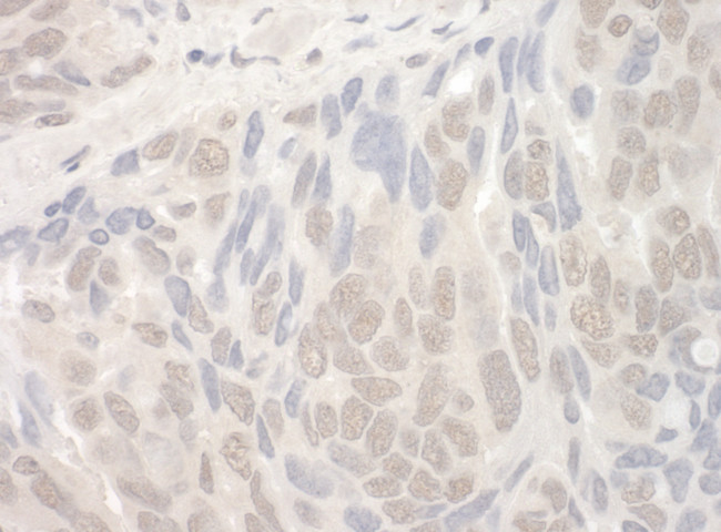 THOC2 Antibody in Immunohistochemistry (Paraffin) (IHC (P))