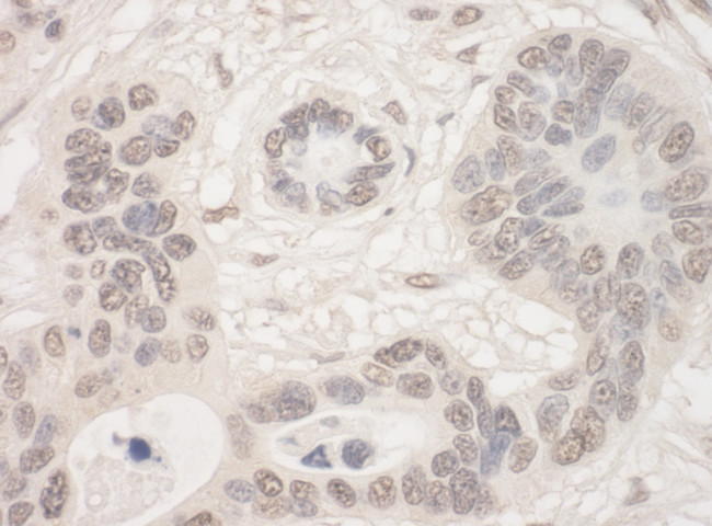 THOC2 Antibody in Immunohistochemistry (Paraffin) (IHC (P))