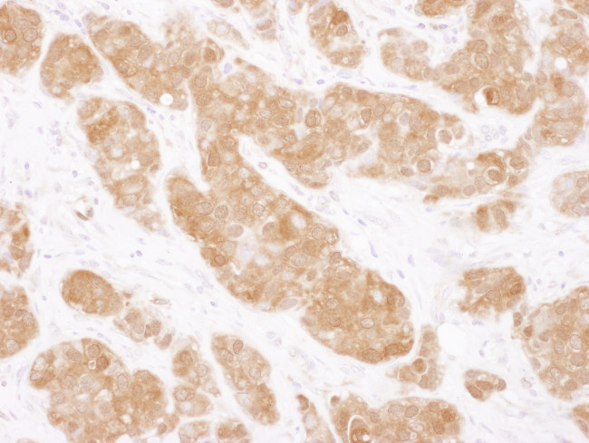 COMT Antibody in Immunohistochemistry (Paraffin) (IHC (P))