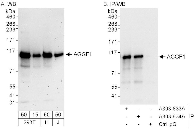 AGGF1 Antibody in Western Blot (WB)
