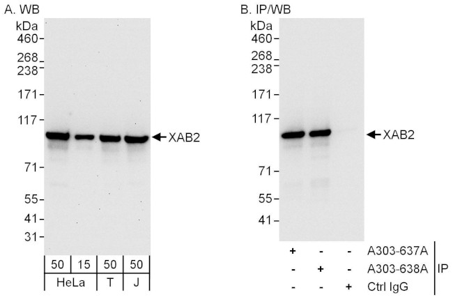 XAB2 Antibody in Western Blot (WB)