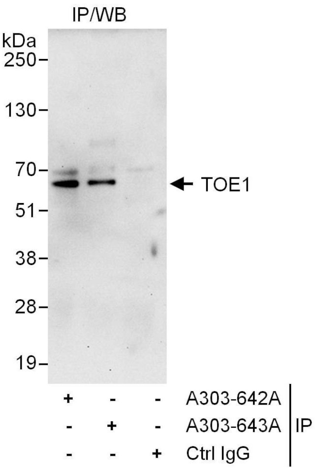 TOE1 Antibody in Immunoprecipitation (IP)