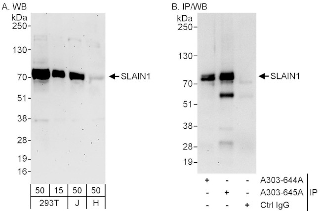 SLAIN1 Antibody in Western Blot (WB)