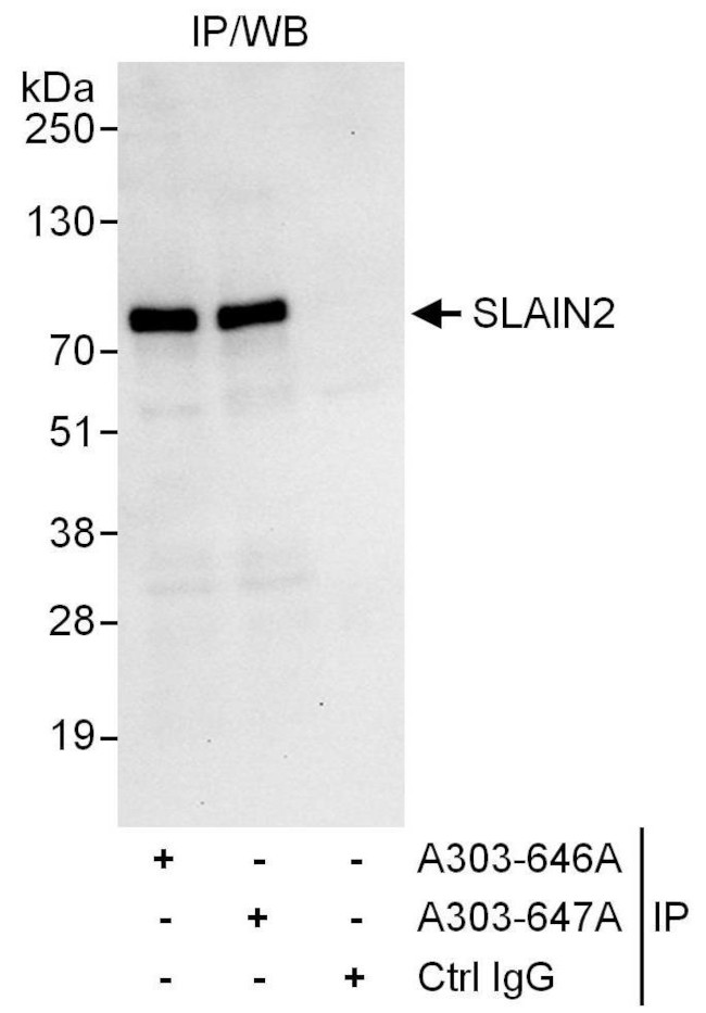 SLAIN2 Antibody in Immunoprecipitation (IP)
