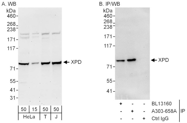 XPD Antibody in Western Blot (WB)