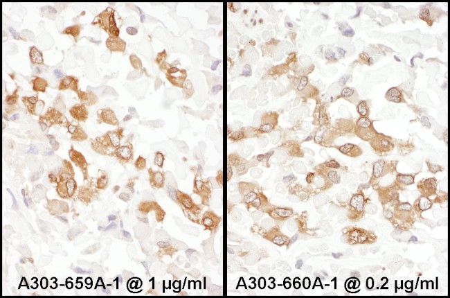 PKM2 Antibody in Immunohistochemistry (Paraffin) (IHC (P))