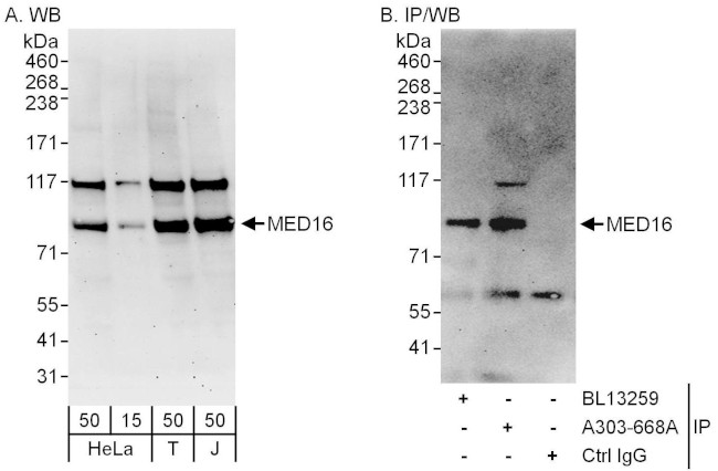 MED16 Antibody in Western Blot (WB)